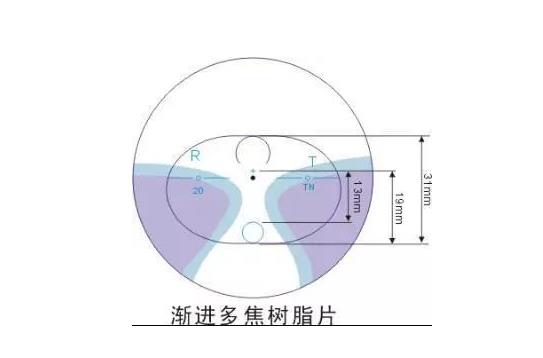 美麗島多焦鏡適合的人群，需要注意的事項